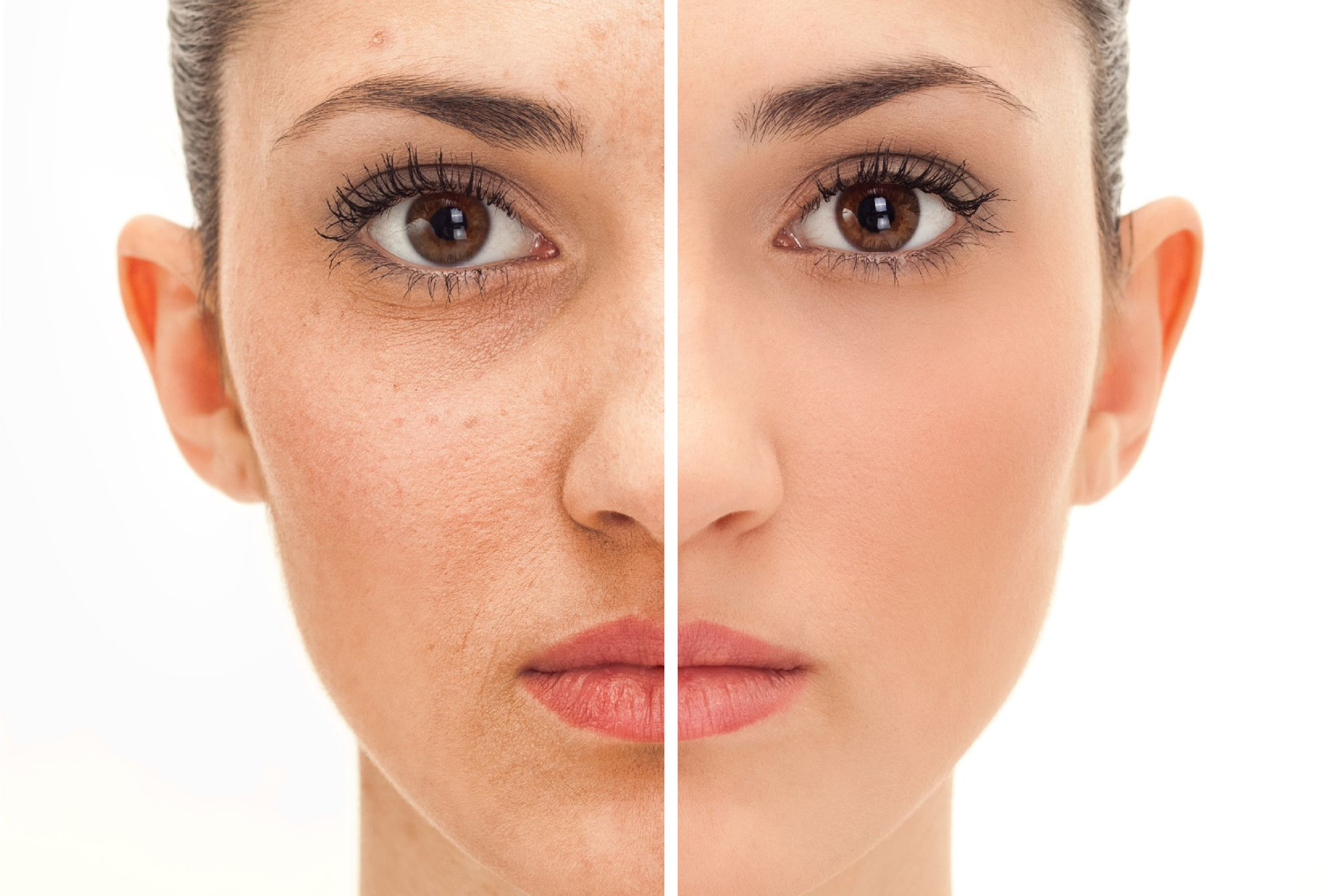 rejuvenecimiento-facial